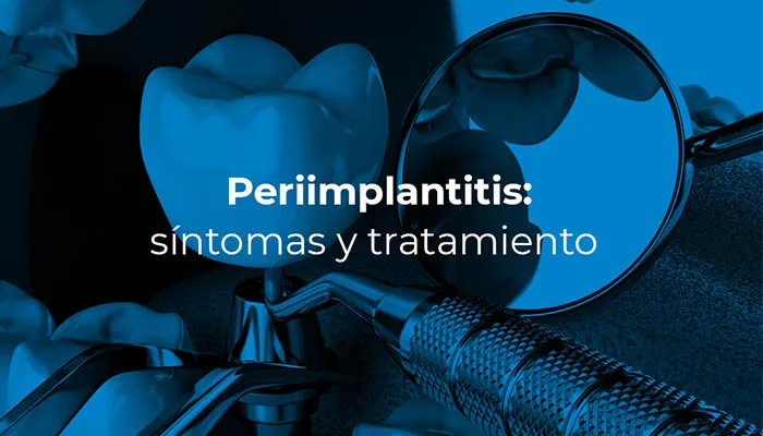 Periimplantitis: síntomas y tratamiento