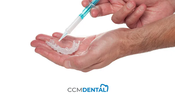 Cuándo hacernos un blanqueamiento dental interno