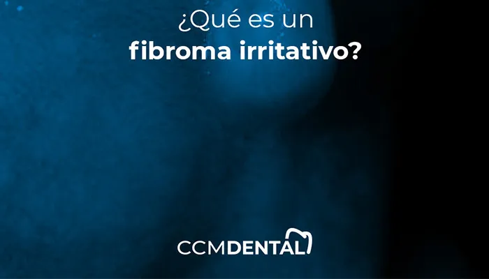 ¿Qué es un fibroma irritativo?