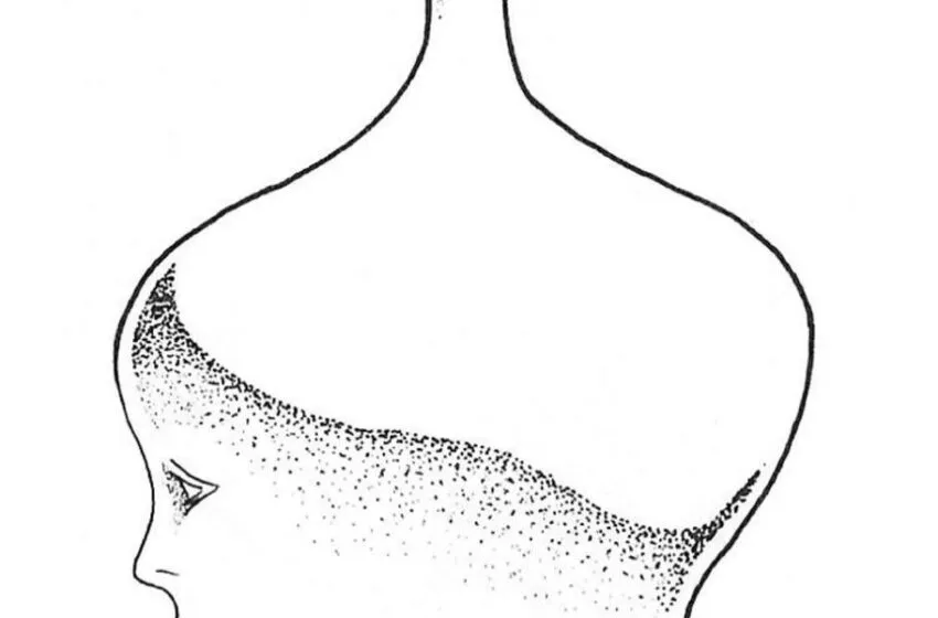  Valdecilla adquiere ‘Emblemas Neurorradiológicos’, obra «extraordinariamente rara» de José Hierro, como broche de oro a su centenario