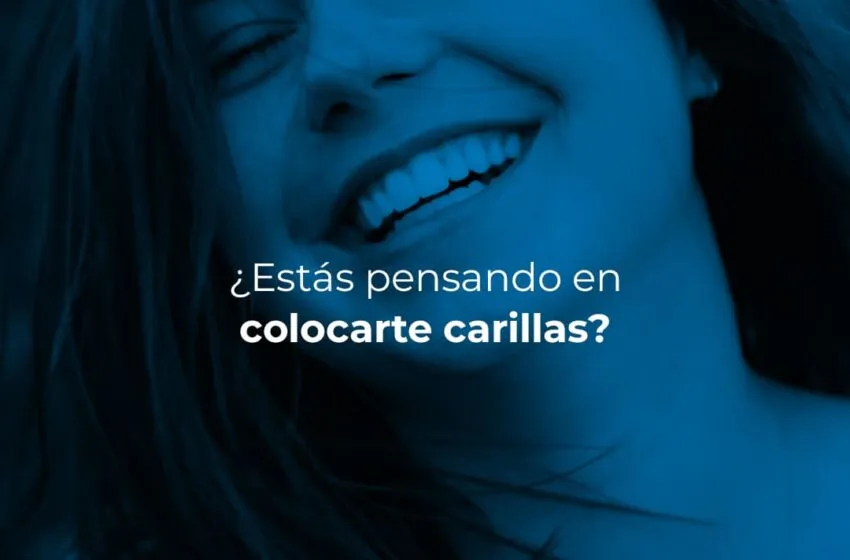 ¿Estás pensando en colocarte carillas?