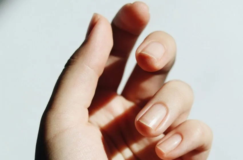 Uñeros o padrastros