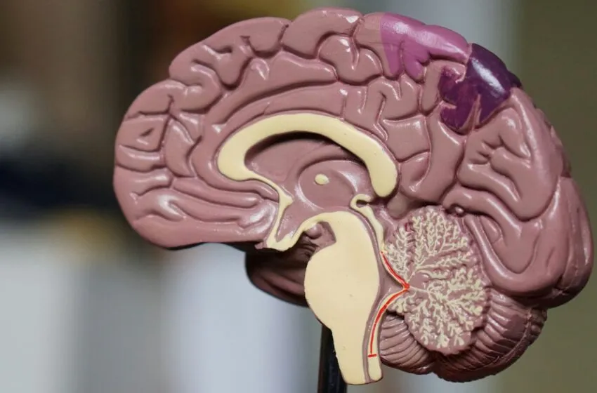 Origen del dolor de la migraña