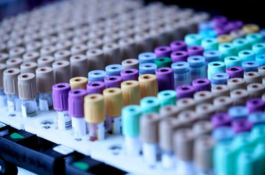 Noticias de Cantabria | El Cántabro | Un estudio determinará los patrones y comportamientos de la población en relación con la donación de sangre y plasma para impulsar la captación de nuevos donantes