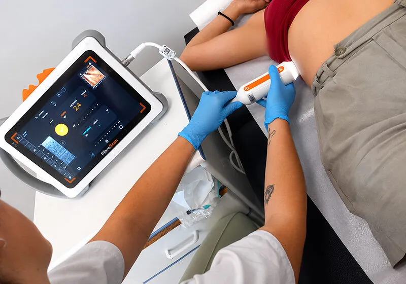 Imagen de una prueba con 'FibroScan', una técnica rápida e indolora, similar a una ecografía, que permite valorar la grasa y la rigidez del hígado (Foto: Gobierno de Cantabria)