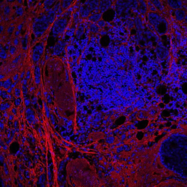 Noticias de Cantabria | El Cántabro | Un estudio liderado desde Cantabria descubre una proteína que frena el avance del cáncer y podría mejorar su diagnóstico