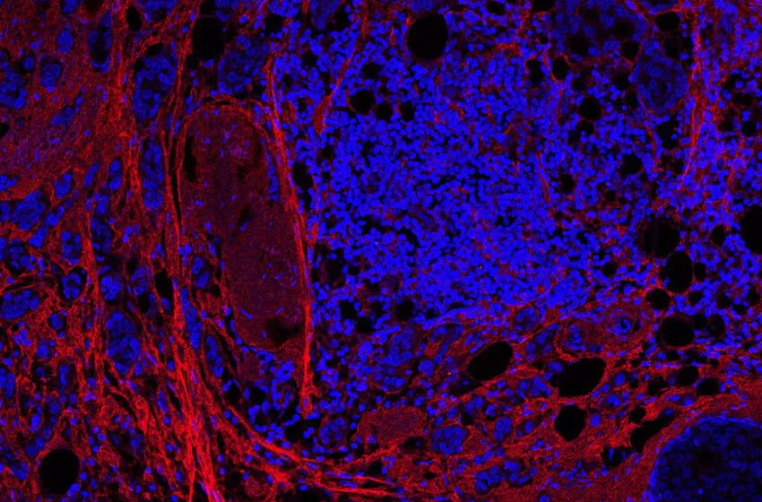 Un estudio liderado desde Cantabria descubre una proteína que frena el avance del cáncer y podría mejorar su diagnóstico